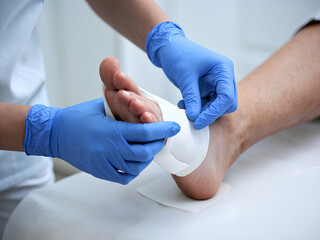 a nurse wearing blue gloves doing bandage on a wound on a person's foot