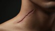 © Tin - Close-up of a healing scar on a neck, showcasing texture and depth, symbolizing resilience and the passage of time.