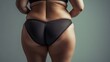 © Yeivaz - Woman with visible cellulite on her thighs and buttocks on gray background. Overweight liposuction