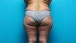 © Yeivaz - Woman with visible cellulite on her thighs and buttocks on blue background. Overweight liposuction