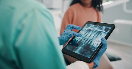 Poster - Clinic, patient and dentist with tablet screen for x ray, teeth diagnosis and dental structure in appointment. Healthcare, person or doctor with tech for orthodontic procedure or planning for surgery