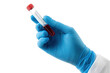 © iridescentstreet - A hand in a blue glove holds a blood sample in a test tube for laboratory analysis in a clinical setting