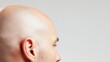 © garpinina - alopecia, Man is showing the top of his head, revealing thinning hair, a common sign of alopecia