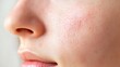 © Li - Close-Up of Skin with Warts, Medical Illustration Highlighting Rough Skin Texture and Common Skin Growths for Dermatological and Health Awareness Concepts.