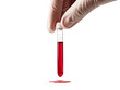 © PTC_KICKCAT - A close-up of a gloved hand holding a test tube filled with red liquid, representing medical testing or laboratory procedures.