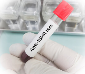 Poster - Blood sample for Anti TSHR Ab test. Thyroid stimulating Immunoglobulin test. Throtropin binding inhibitory Immunoglobulin.