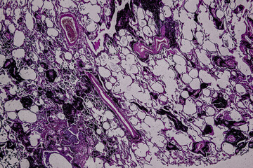 Pathology and Histology Tissue of Mammals under microscope.