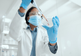 Poster - Scientist, pipette and petri dish with blood in laboratory for medical research, experiment or DNA testing. Science, dropper and hands of pathologist with RNA engineering discovery for healthcare.
