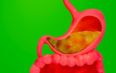 Wall Mural - Symptoms of acid reflux or excess acid in the stomach. Gastric juice and intestinal model within the abdominal cavity. Pressure or air causes stomach pain. 3D Rendering.green screen