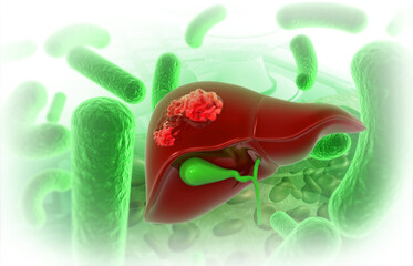 Wall Mural - Human liver virus infection. 3d illustration