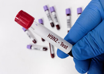 Poster - Blood Sample for Avian Influenza A (Subtype H9N2) test. H9N2 PCR test. Influenza virus. Rapid Influenza Antigen.