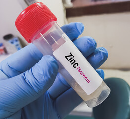 Sticker - Semen sample for semen zinc test for identification of human seminal stains.