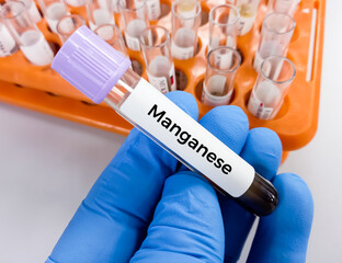 Sticker - Blood sample for Manganese (Mn) test, to evaluate central nervous system, blood toxicity test. Manganese deficiency.