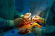 © ungvar - Medical team of surgeons perform open heart surgery on patient in operating room at hospital