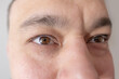 © kittyfly - Intense gaze, Male Brown Eyes close-up, young Caucasian man looking, Masculine beauty, vision examination, myopia, eye fatigue, color perception