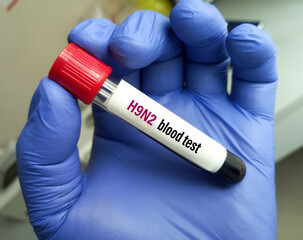 Poster - Blood Sample for Avian Influenza A (Subtype H9N2) test. H9N2 PCR test. Influenza virus. Rapid Influenza Antigen.