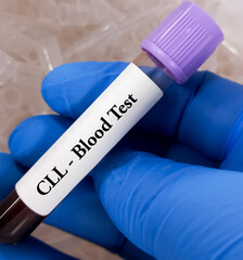 Sticker - Chronic Lymphoblastic Leukemia (CLL) blood test. Blood cancer.