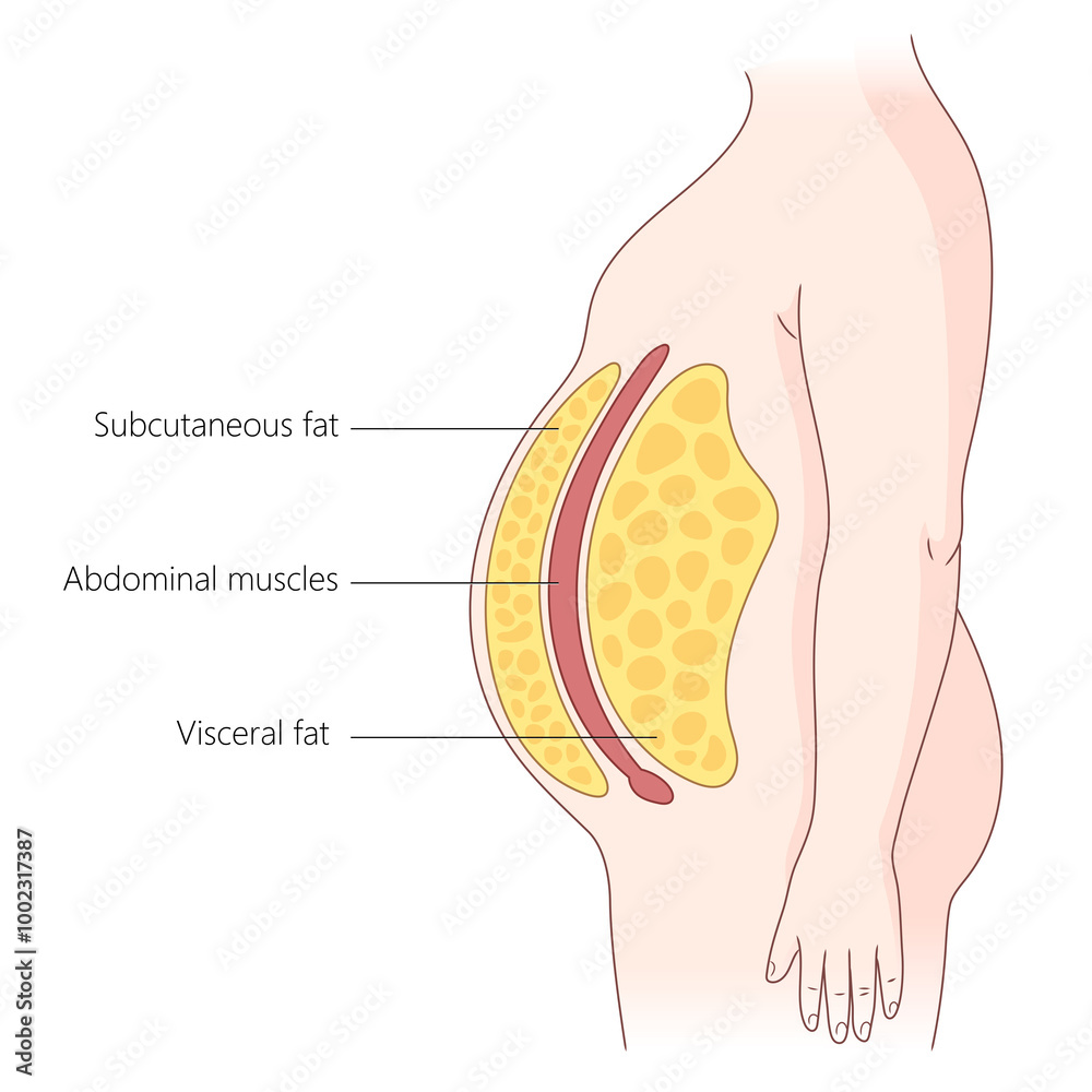 layers of subcutaneous and visceral fat in the human abdomen, abdominal ...