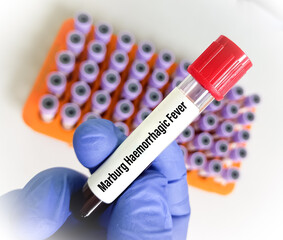 Poster - Blood sample for the Marburg virus test. Medicine and health concept. Marburg haemorrhagic fever.