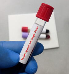 Wall Mural - Blood sample for the Marburg virus test. Medicine and health concept. Marburg haemorrhagic fever.