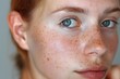 © Vadym - Young woman facial skin with freckles, skin discoloration. Effective skincare solutions for dark spots, hyperpigmentation, uneven tone. Dermatology treatments, exfoliation, sun protection, vitamin,