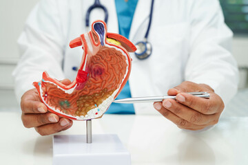 Stomach disease, doctor holding anatomy model for study diagnosis and treatment in hospital.