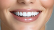 © A-TiMe  - Close-up of a smiling woman highlighting her beautiful white teeth.