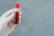 © WinThing - Hand holding a blood sample tube with red liquid and a protective glove.