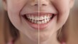 © AlfaSmart - Teeth Whitening Before and After: A Radiant Smile Transformation