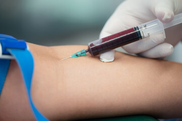 Medical Blood Draw from Arm. A close-up image of a healthcare professional drawing blood from a patient's arm using a syringe. 