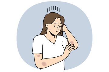 Woman with bruises on arms is sad and looks at abrasions received after fall or accident on road. Depressed girl needs healing ointment for bruises and wounds left due to domestic violence