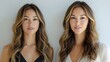 © Alpha - Before-and-after rhinoplasty testimonial, detailing the patient's experience, from pre-surgery concerns about nose shape to the final, perfectly sculpted nose post-surgery