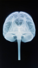 Aufkleber - Anatomical X ray of human brain showcasing cranial structure and neural pathways, highlighting intricate details of brains anatomy