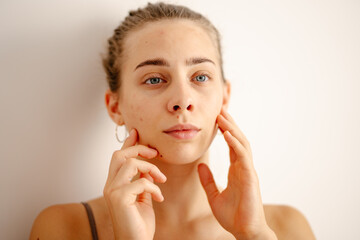 Wall Mural - A young woman inspects her skin in natural light. Concept of acne therapy, scars, inflammation.