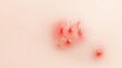 © Navaporn - Closeup of red, raised urticaria patches on light skin, inflamed and irritated