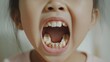 © Sinechana - 2408 4.An Asian child with their mouth open, displaying noticeable dental caries in their upper teeth. The cavities are dark and visible, emphasizing the need for dental care.