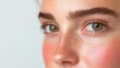 © ImagineWorld - Close-Up of Woman's Face with Freckles and Rosy Cheeks Highlighting Natural Skin Texture and Condition