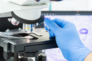 Wall Mural - Scientist wear blue glove holding parafin human tissue block and out of focus microscope and computer monitor show glandular image.Medical patholology and cytology laboratory technology concept.