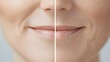 © Alpha - Tutorial video featuring a detailed guide on reducing wrinkles around the mouth with anti-wrinkle cream, showcasing the transformation with before-and-after comparisons, Realistic Style