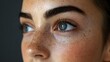 © Alpha - Document the transformation of skin texture and pigmentation before and after a combined facial treatment of Botox and melasma spot reduction
