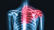 © Marketplace - Detailed X-ray image of a human spine highlighting shoulder pain, showcasing an anatomical view. Ideal for educational and medical use.
