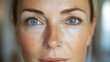 © Alpha - Close-up of a patient's face before and after a facelift procedure, highlighting firm skin and youthful contours, High-Resolution, Natural Colors, Realistic