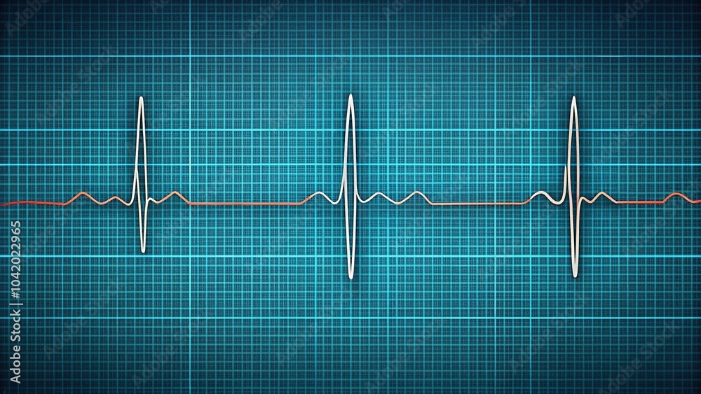 Reflected ecg waveform showing normal atrial and ventricular ...