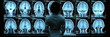 © sommersby - A medical expert analyzes a series of brain scans displayed on monitors in a healthcare facility, focusing intently on the images