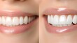 © Alpha - Close-up before-and-after images of a smile, illustrating the instant transformation from dull to bright white teeth, Realistic, Bright Lighting, Minimalist Design