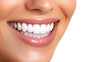 © Nattapol - close up of smiling woman showcasing her bright, white teeth and healthy gums, radiating joy and confidence