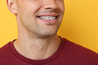 © New Africa - Smiling man with dental braces on yellow background, closeup