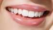 © fan - close up of woman with braces