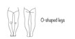 © Anna - O-shaped legs