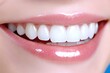 © Modern Angles - Beautiful Smiles: Closeup of Woman's Teeth Whitening Treatment by a Professional Dentist for Optimal Dental Health - Isolated on Blue Background